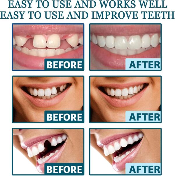 1 par de prótesis dentales ajustables con clip - Image 8