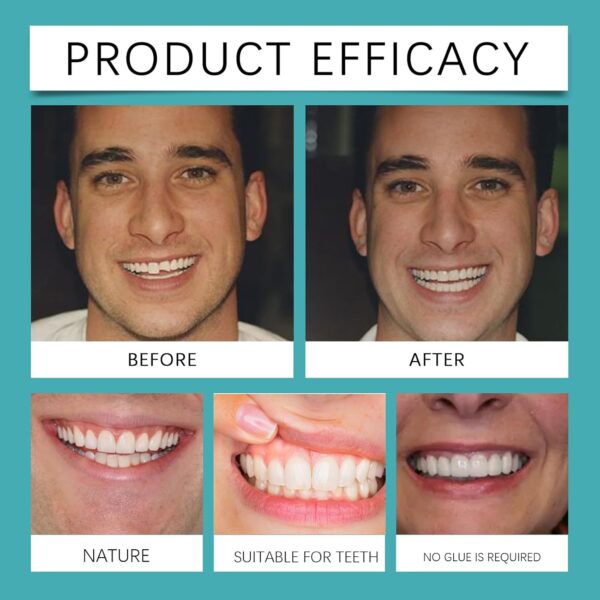 1 par de prótesis dentales ajustables con clip - Image 9
